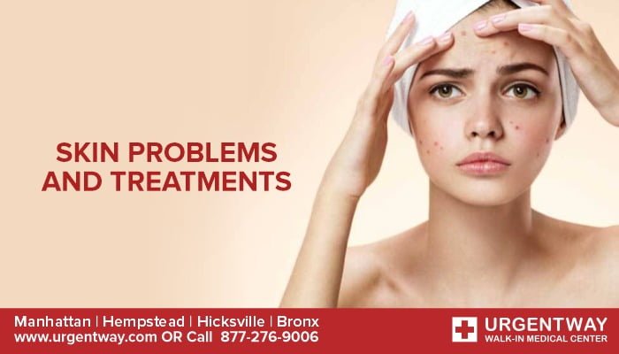Common Skin Problems And Treatments