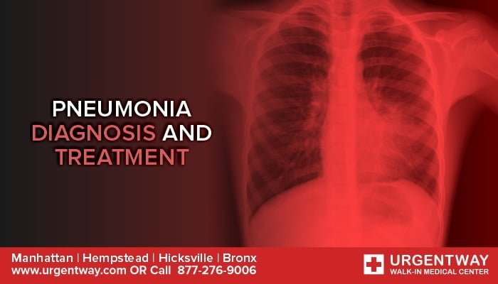 Symptoms Of Pneumonia – Diagnosis And Treatment