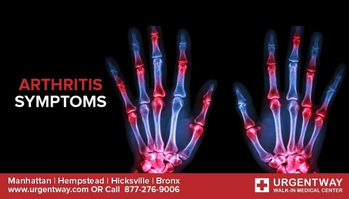 arthritis symptoms